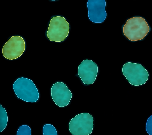 Why Imaris 11 is a Game-Changer for Automated Microscopy Workflows