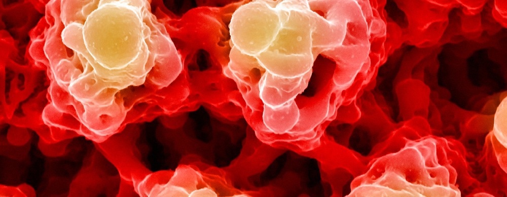 Harnessing Dose-Fractionated EELS for Advanced Materials & Cryo-EM Spectroscopy