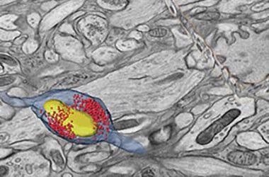3D reconstruction of a mouse hippocampal organotypic slice culture.