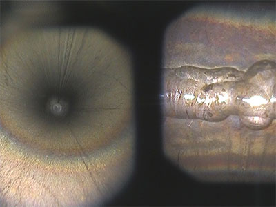 the IPLEX GX/GT Videoscope
