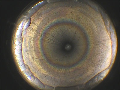 the IPLEX GX/GT Videoscope