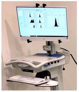 Portable On-Line Shape Analyzer System: Pi PMS