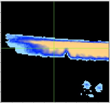 Razor blade (field of view 2 mm2). 31CF from Lubrication.