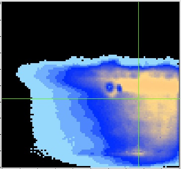Razor blade (field of view 2 mm2). 23Na from heat treatment.