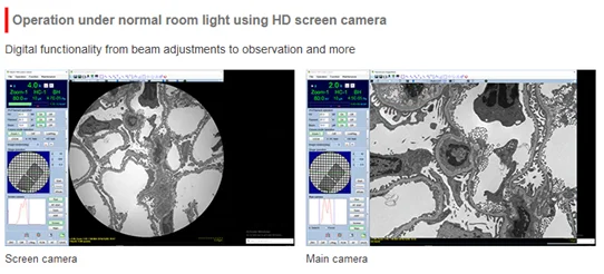The HT7800: A 120 kV Transmission Electron Microscope