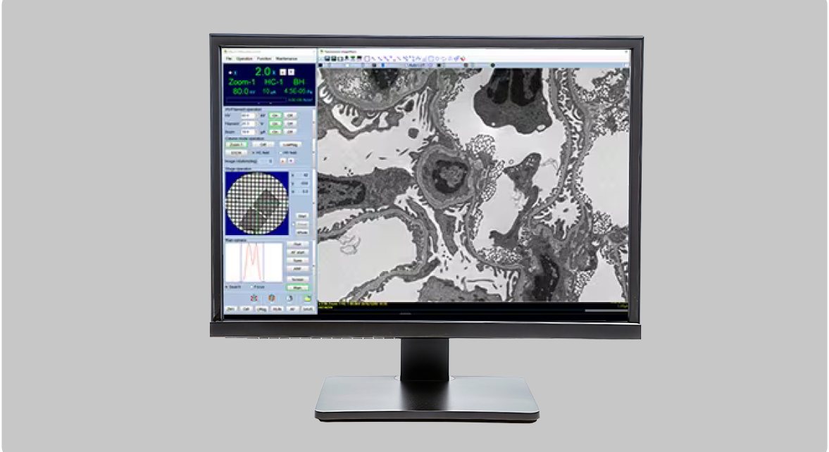 The HT7800: A 120 kV Transmission Electron Microscope