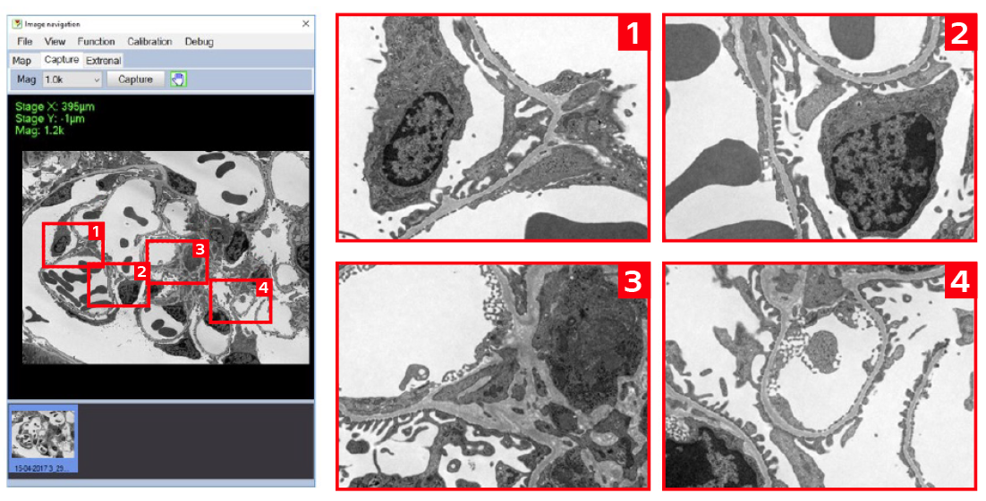 The HT7800: A 120 kV Transmission Electron Microscope