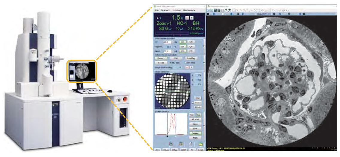 The HT7800: A 120 kV Transmission Electron Microscope