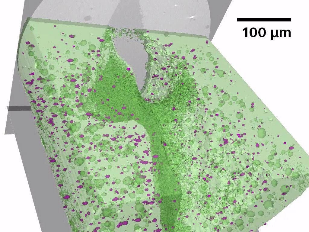 Inner structure of an AM manufactured aluminum gear wheel; 3 µm voxel resolution imaging is used to see unmelted particles, High-Z inclusions, and small voids.