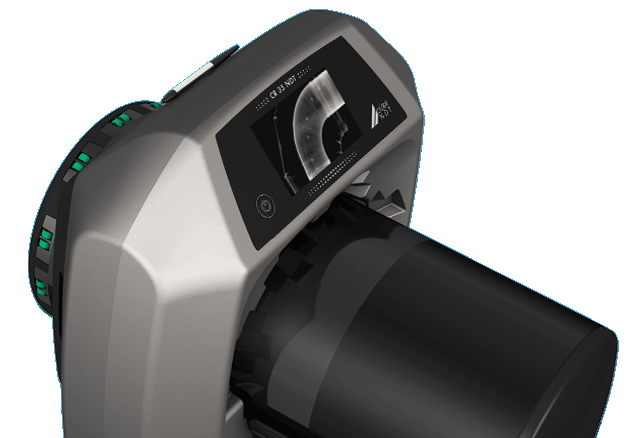 Portable Digital X-Ray CR Scanner
