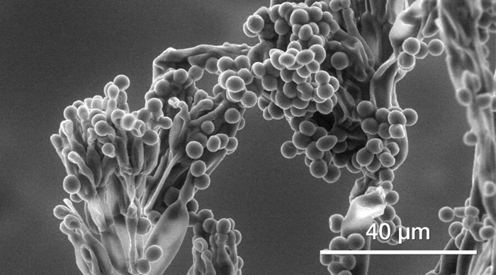 Hydrated mold spores (ESEM imaging, 800 Pa).