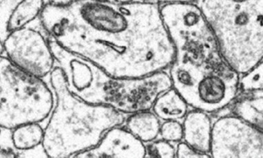 Mouse brain sample imaged on the Volumescope 2 SEM. Fine features such as vesicles and synaptic clefts can be observed.