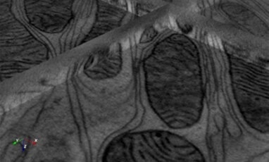 Tomography post-alignment and reconstruction module.