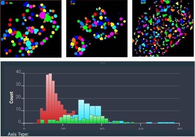 Avizo Software provides automated nanoparticle analysis in TEM. Here, EDS analysis counted the number of particles containing chlorine (light blue), nickel (green), and gold (red) and produced a histogram of their relative particle sizes. Sample courtesy of J. Bursik, Institute of Physics of Materials, Brno.