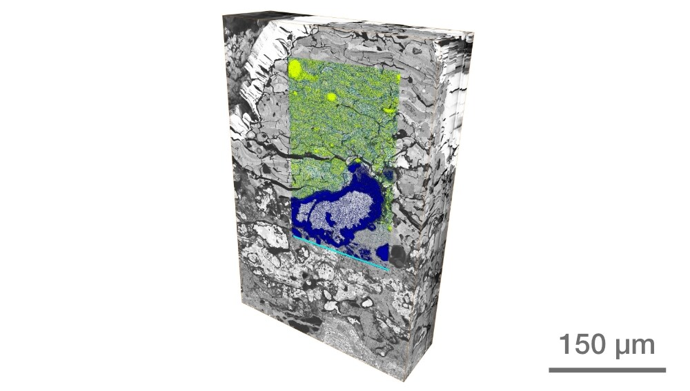 3D reconstruction of the thermal barrier coating on a ramjet aero engine afterburner nozzle showing the microstructure state at the end of the exhaust system’s life. The overlaid EDS map shows elemental distribution on the top coat and bond coat interface: blue is aluminum, yellow is magnesium, and turquoise is yttria. Data produced using a Thermo Scientific Helios 5 PFIB, Auto Slice & View 5 Software, and Avizo Software for materials science. Scale bar is 150 microns.