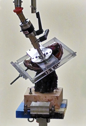 Cervical torsion test.