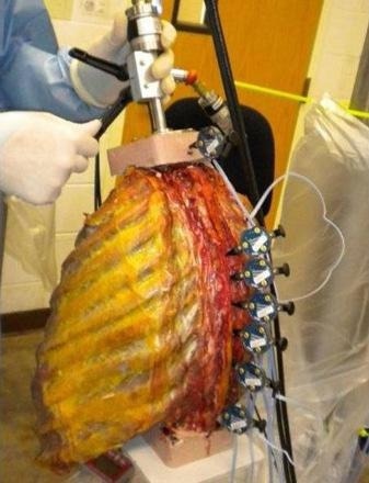 Ribcage specimen ready for test with optical sensors.