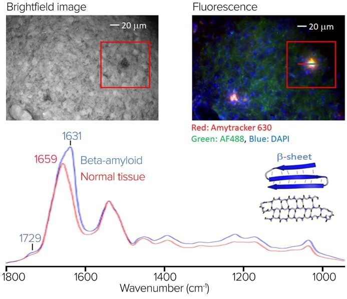 (top left) The brightfield image of the stained sample. (top right) The RBG composite fluorescence image. (bottom) An averaged O-PTIR spectra, from the line profile shown in the RBG composite fluorescence image