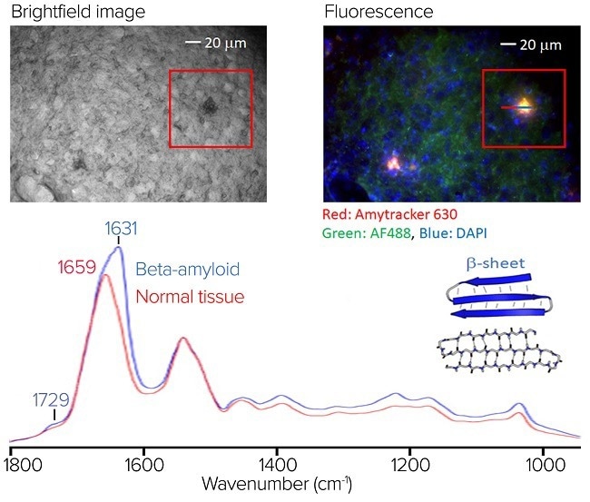 (top left) The brightfield image of the stained sample. (top right) The RBG composite fluorescence image. (bottom) An averaged O-PTIR spectra, from the line profile shown in the RBG composite fluorescence.