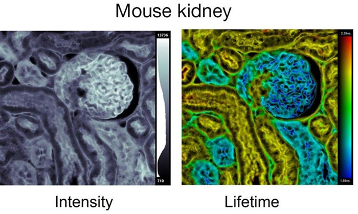 InverTau™: Fluorescence Lifetime Imaging Platform