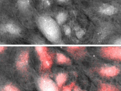 UPDATES - Lyncée Transmission Series: Real-Time Quantitative Imaging for Life Sciences and Materials Science