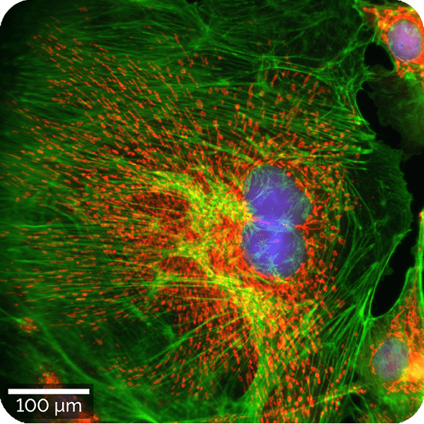 How the witec360 Raman Microscope is Redefining Nanoscale Imaging