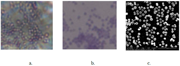 a) Staphylococcus aureus imaged with SMAL; (b) conventional 100× objective; (c) TEM.