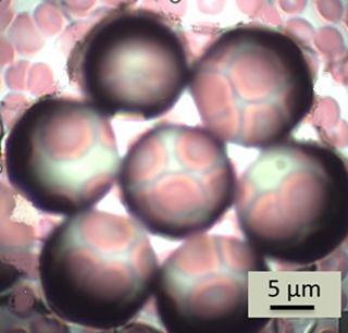 Red blood cells (erythrocytes) imaged with a Multi-Spheres SMAL (Super-resolution Microsphere Amplifying Lens); each microsphere provides a localized super-resolved sub-field