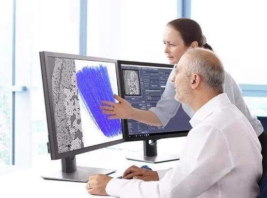 Iterative Reconstruction with ZEISS OptiRecon