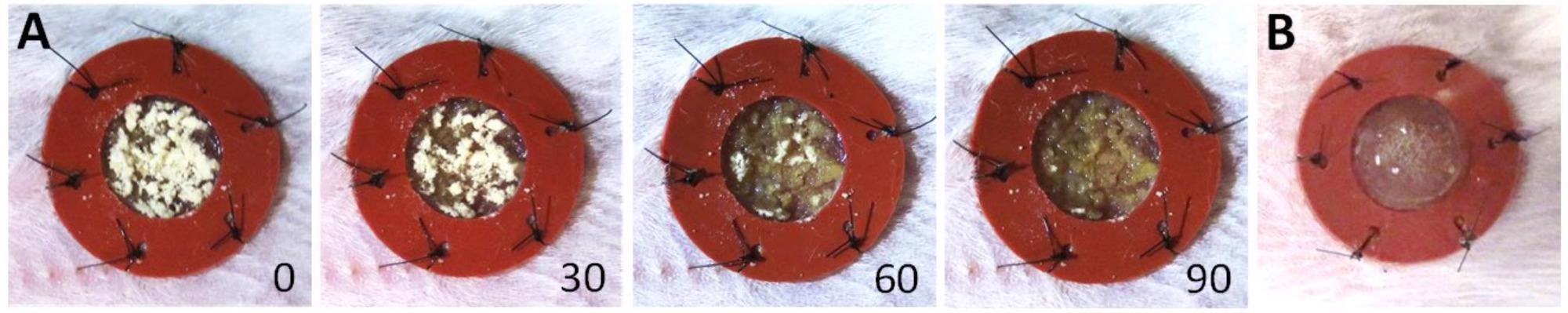 Powder vs gel scaffold comparison and rehydration time within the wound bed. (A) Upon application of the powder scaffold to the open wound, representative images of powder rehydration as a function of time are depicted. Photographs were acquired at time of application—0 s, 30 s, 60 s, and 90 s. (B) Depiction of the original gel scaffold is provided for comparison.