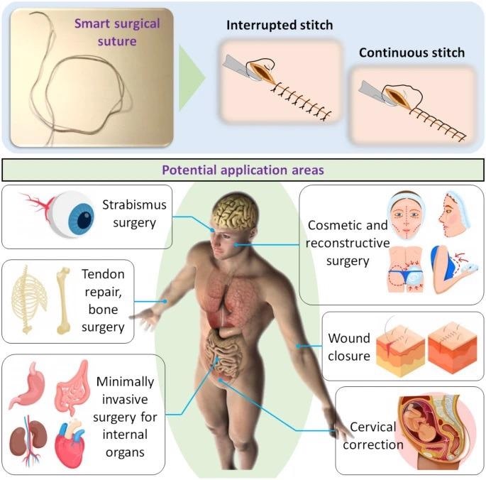 Smart surgical suture with two typical surgical stitches and their potential application areas. The pictures of strabismus surgery, tendon repair, bone surgery, minimally invasive surgery for internal organs, cosmetic and reconstructive surgery, wound closure, and cervical corrections were “Designed by Freepik”.