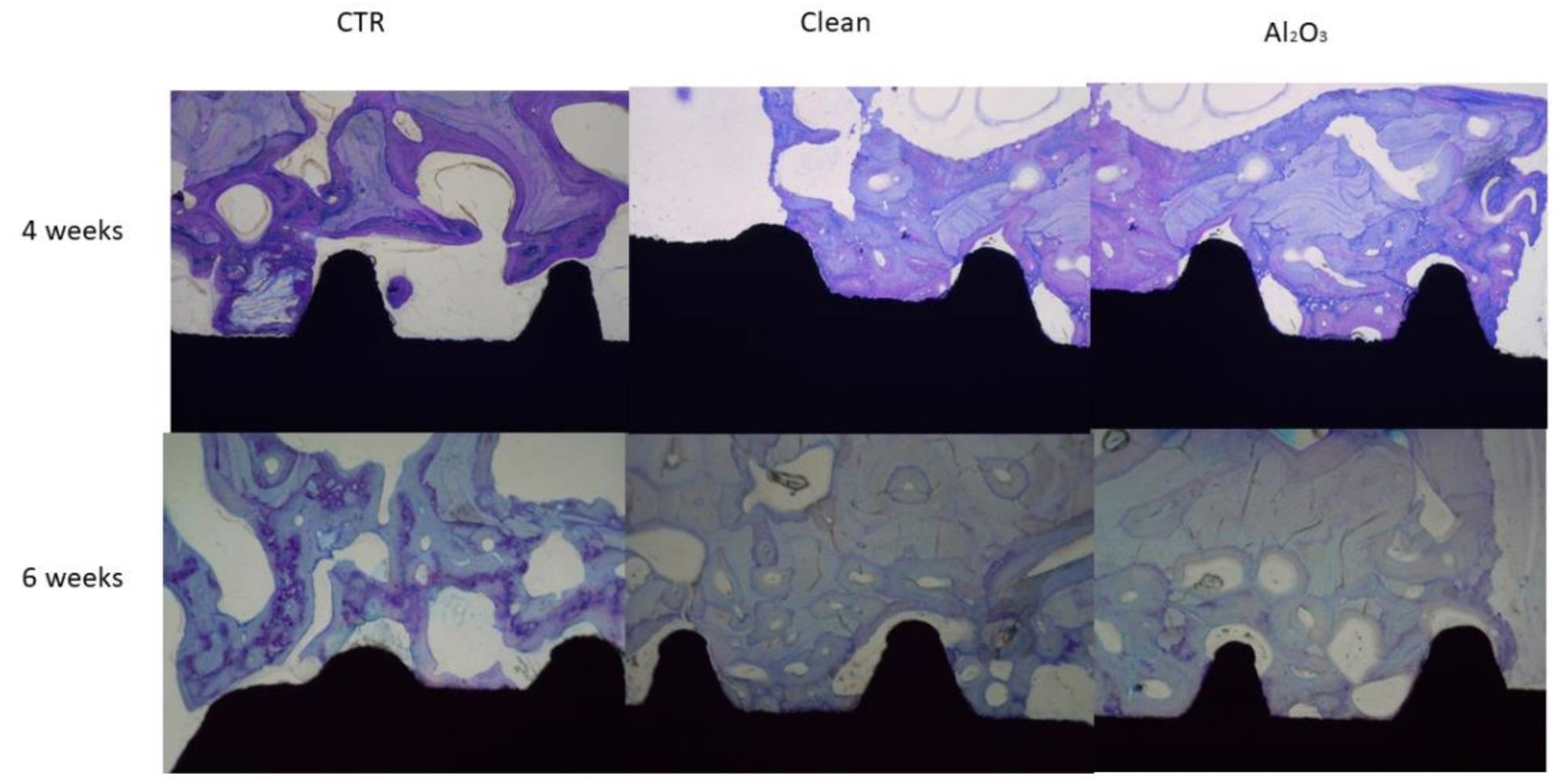 Histologies of the dental implants after 4 and 6 weeks of implantation for the three surfaces studied.