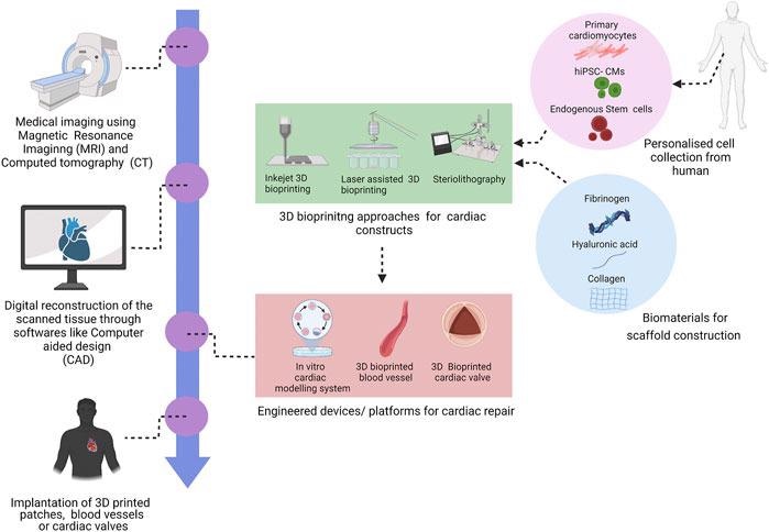 3D bioprinting technology for cardiac repair and regeneration.