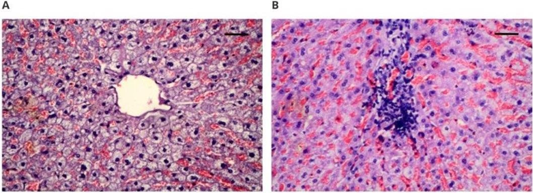 Microscopically assessed image of the heart muscle obtained from implanted animals: (A) 100× magnification (scale bar 100 µm), hematoxylin–eosin staining magnification; (B) 100× magnification (scale bar 100 µm), Masson’s staining.