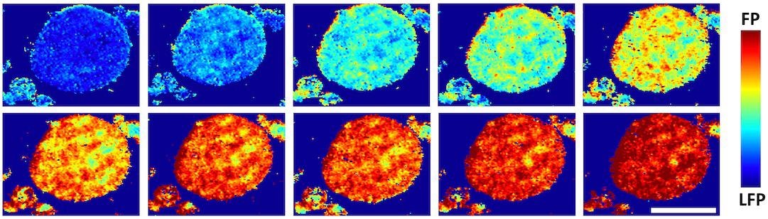 Study Proposes Stress Among Misaligned Particles in Typical Cathodes Limits Flow.