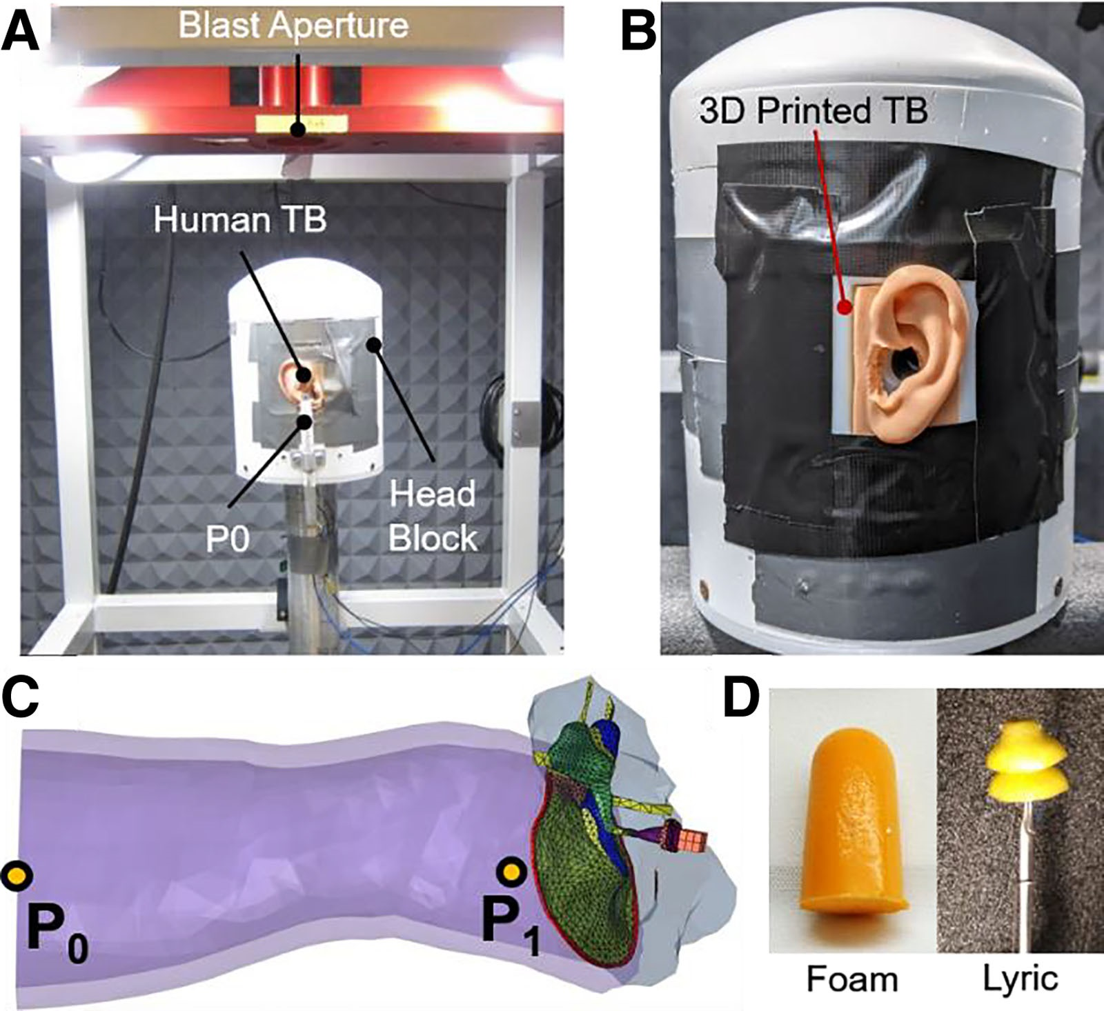 Experimental blast setup and pressure sensor placements used to measure blast wave transmission in ear models. A, Image of the blast test setup within an anechoic chamber where the “head block” sits below the blast aperture. A human cadaveric TB is mounted to the head block and the pressure sensor P0 is mounted outside of the ear canal entrance. B, Image of the 3D printed TB mounted to the head block. C, The finite element model highlighting where the pressures were monitored during blast exposure: at the entrance of the ear canal, P0, and in the ear canal near the TM, P1. D, Images of the foam earplug (left) and Lyric earplug with a stick holder (right) used in blast exposure tests. TB indicates temporal bone; TM, tympanic membrane.