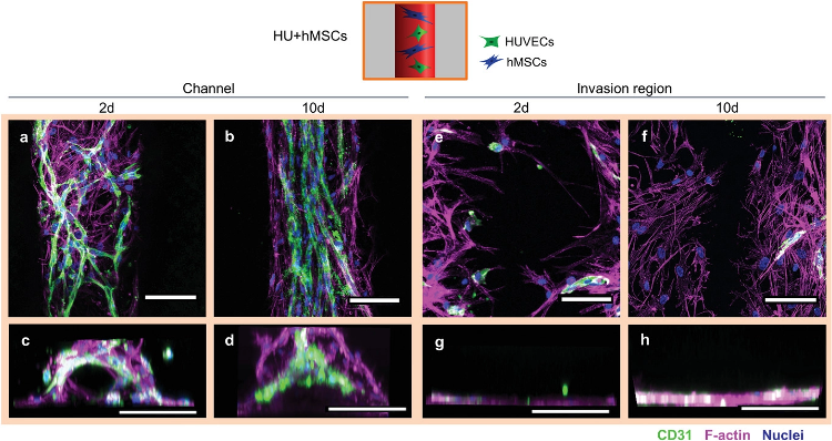 Cellular arrangement of HUVECs and hMSCs printed in proximity in the channel (Group HU+hMSCs). a) Representative confocal images of the channel with HUVECs (green) forming vascular structures as early as 2 days post printing. hMSCs (magenta) in proximity spanning in between newly forming vascular structures. b) Representative confocal image after 10 days showing more mature microvascular structures, with a constant diameter and hMSCs aligning with the strongly oriented vascular structures along the channel direction. c) Representative front view image of the channel 2 days after printing with cells initially attach to channel surface. d) Representative front view image of the channel 10 days after printing completely filled by cells. e,f) Representative images of the invasion region 2 and 10 days after printing with little immigration of HUVECs, but strong immigration of hMSCs from the channel. g,h) Front view reconstructions of the invasion region 2 and 10 days after printing with no cells penetrating the bulk material. Samples were stained for CD31 (HUVECs, green), nuclei (blue) and F-actin (hMSCs and HUVECs, magenta). Scale bars: a,b,e,f) 50 µm, c,d,g,h) 200 µm.