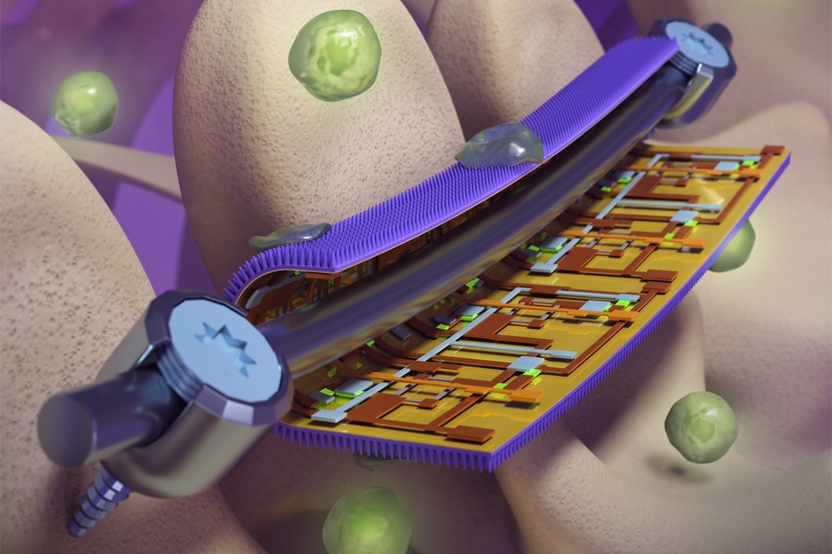 "Smart" Polymer Foil Coating For Orthopedic Implants