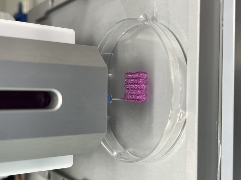 Development of 3D Bioprinting Technology That Could Eradicate Cancer Cells