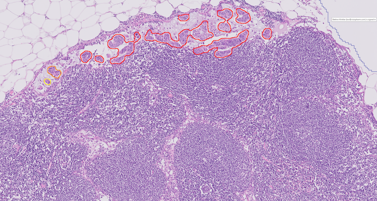 EVIDENT Announces Alliance to Automate Digital Pathology Workflows