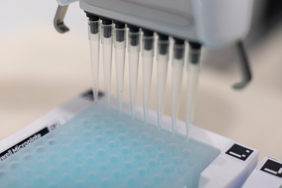 PFAS analysis: Reliably detecting eternity chemicals