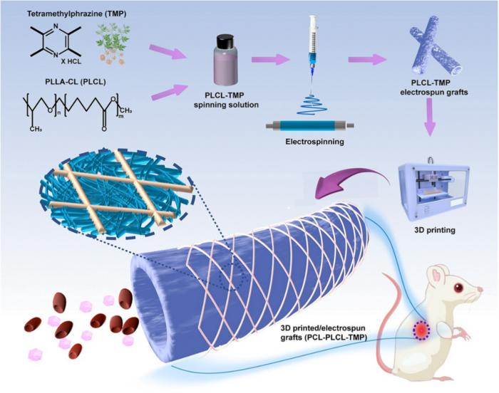 3D Printing Technology Advances Vascular Graft Design