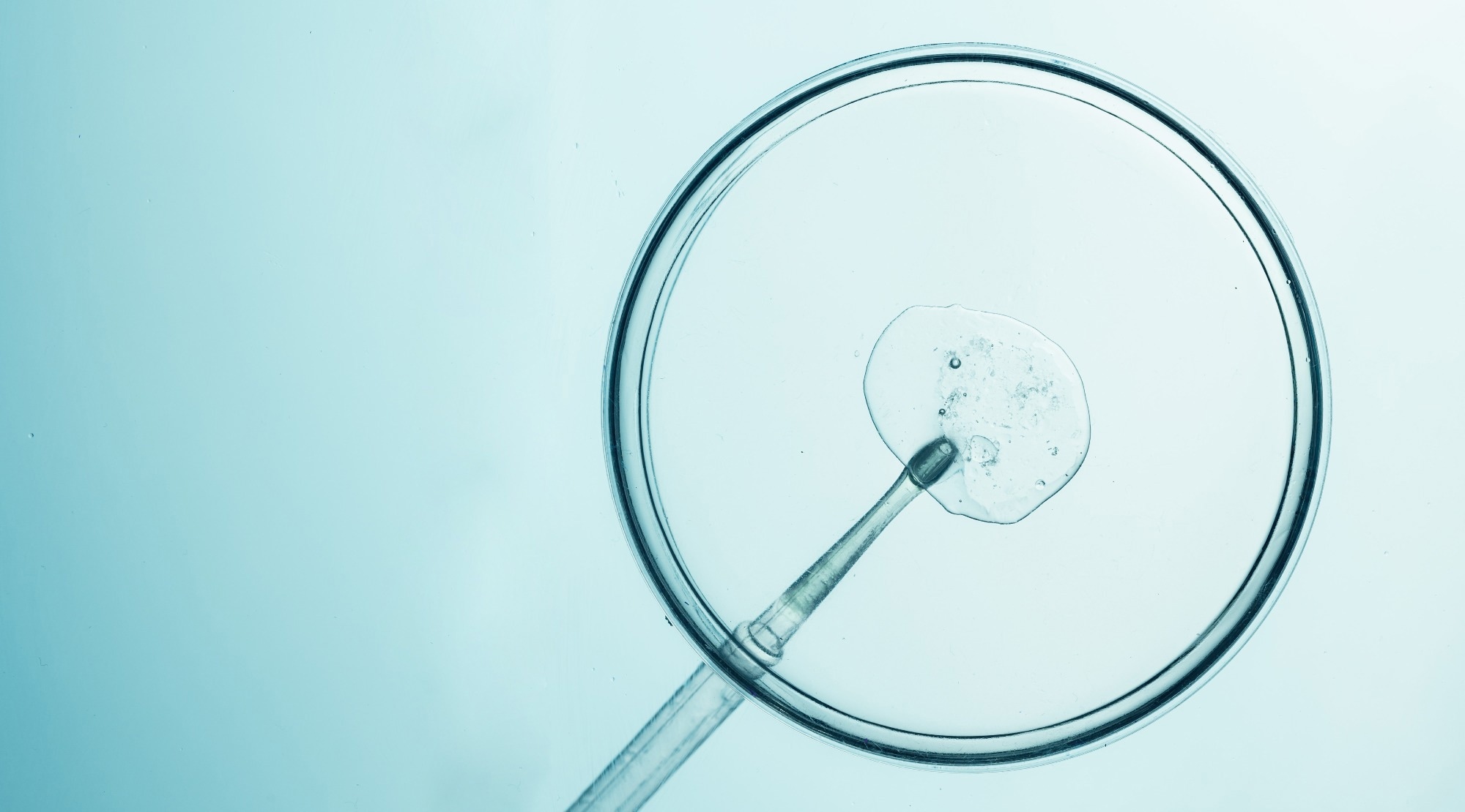 Petri dish and pipette