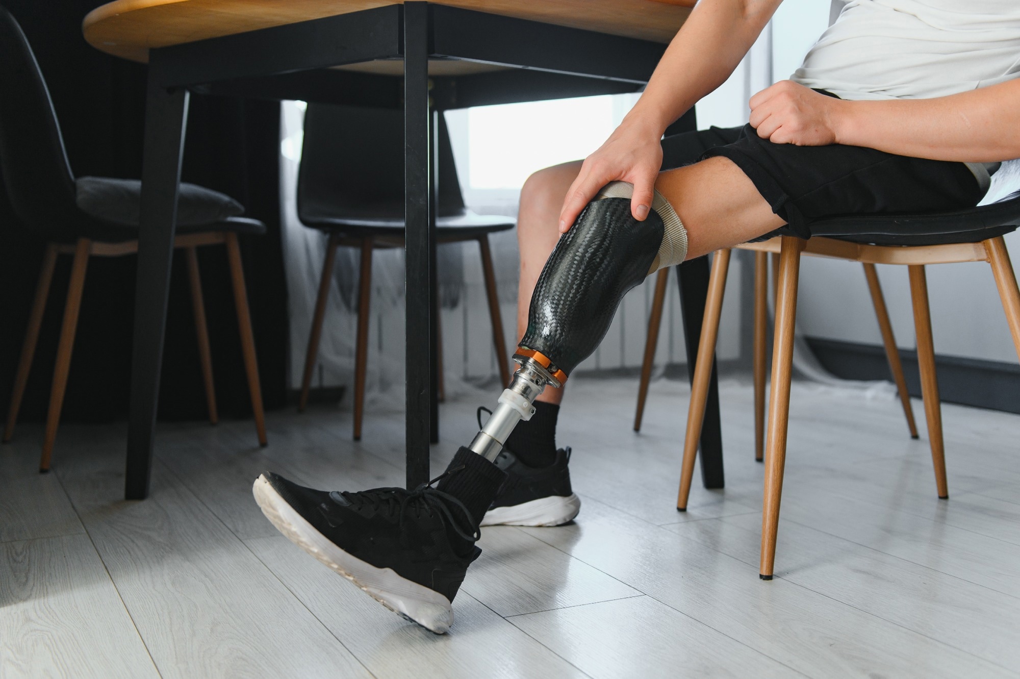 portrait of man with prosthetic leg sitting.