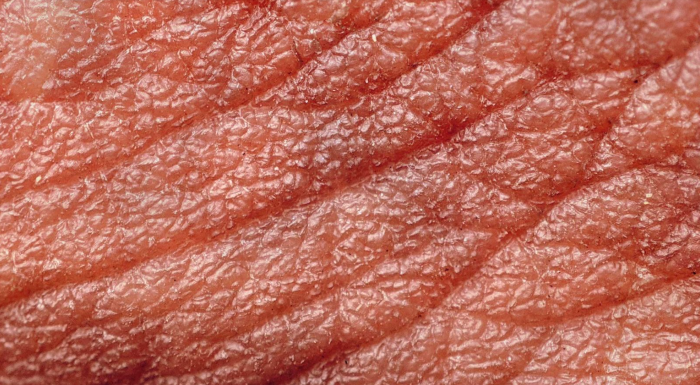 Scientists Have Created Artificial Skin that Can Sense, Heal and Adapt