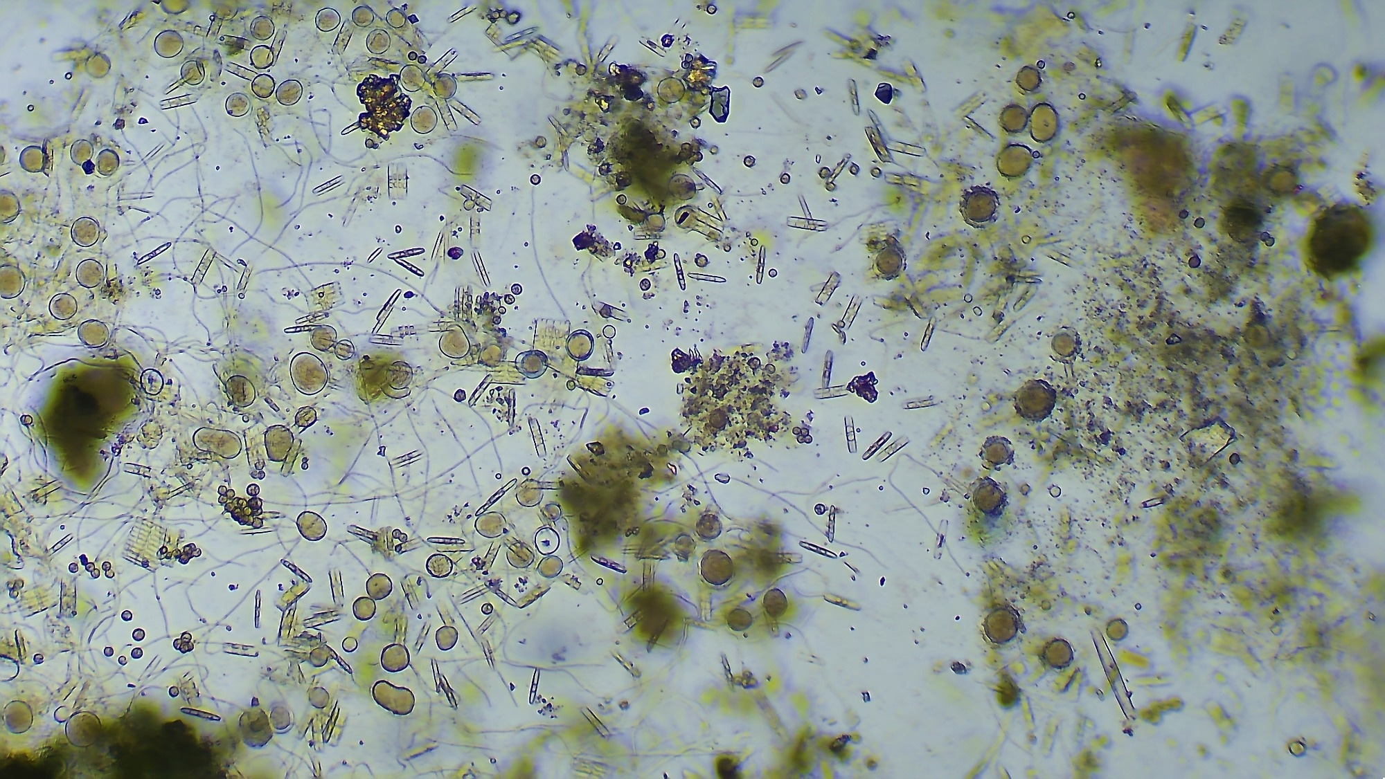 Micro organisms - diatoms and bacterias, magnification 40x