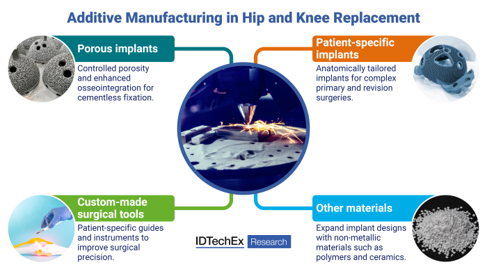 How 3D Printing is Reshaping the Future of Hip and Knee Replacements