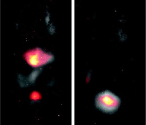 Nanoparticles Called Cornell Dots Highlight Tumors for Removal