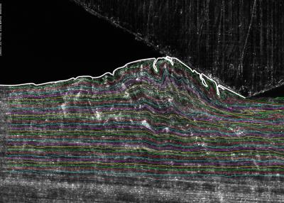 Swirling Fluid-like Behavior Observed In Sliding Metals