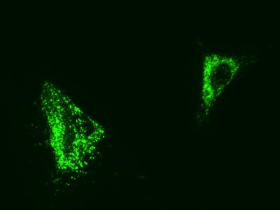 Researchers Hope to Design Biomaterials to Transform Stem Cells into Useful Tissues
